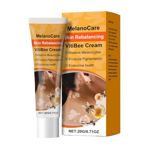Aceirropy Crema Antimanchas Corporales - Crema Eliminadora de Hiperpigmentación | Humectante y Nutriente Reductora de Manchas para Cuidado Nocturno de Mujer en Rostro y Cuerpo
