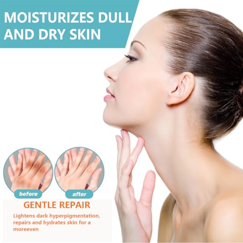 Spot Remover For Body, Spot Corrector Cream,- Underarm, Neck, Armpit, Knees, Elbows, Private Areas, Intimate Areas (Acanthosis 3Box)