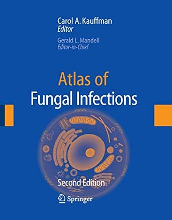 Buy ATLAS OF FUNGGAL INFECTIONS, 2ND EDITION Book Online at Low Prices ...