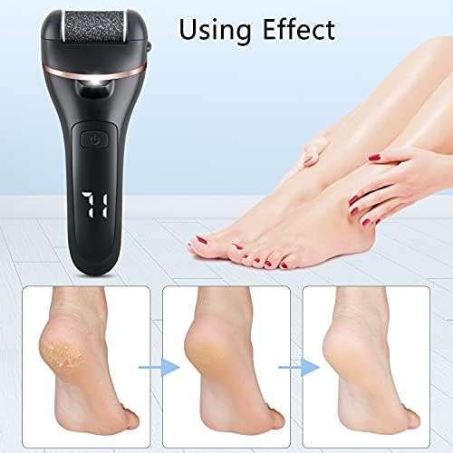 ZOUYUE Electric Foot File Pedicure Set, Rechargeable Waterproof Hard Skin Remover with 3 Rollers and 2 Speeds, Callus Remover Foot Care Gift Kit for Cracked Heels Calluses and Dead Skin(Black)