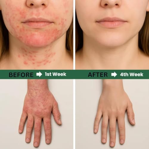 Power Grain Eczema Support Supplement