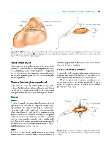 Vias De Acesso Em Cirurgia Ortopedica: Abordagem Anatômica