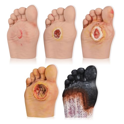 5 Pcs Diabetic Foot Care Model