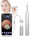 ✹【OVIFM D10-No es Solo un Otoscopio】 No solo se puede usar como endoscopio, sino también como microscopio digital, como un buen ayudante para revisar la cavidad bucal, la cavidad nasal, la piel y otras partes del control de salud. Este camara endoscopica es apto para adultos y niños. Por supuesto, no solo endoscopio para movil para humanos, sino también otoscopio medico、otoscopio veterinario