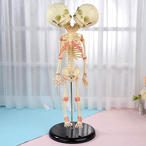 Menschliches Doppelkopf-Baby-Skelett-Anatomiemodell - medizinisches anatomisches Schädelmodell - für den Display-Studienunterricht medizinisches Modell, medizinische Ausbildungshil Cover