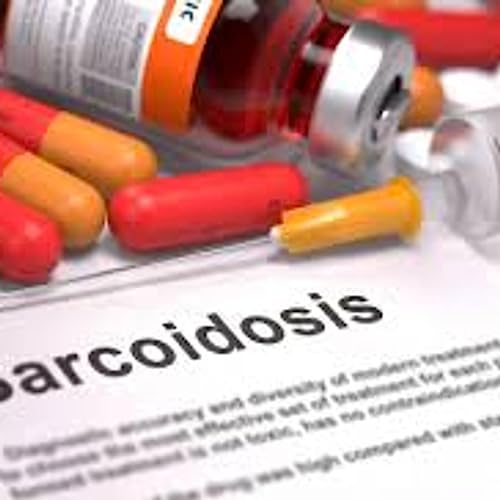 Sarcoidosis: Disparities in Healthcare & the Importance of Diversity in Clinical Trials