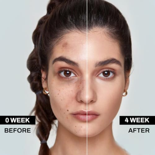 Dark Spot Remover for Face and Body, Dark Spot Corrector Serum with 20,000ppm Niacinamide & Licorice Root, Lightweight Face Serum for Sun Spots, Age Spots, Freckles, Hands, Neck & Uneven Skin Tone — view 3