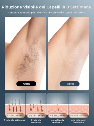 Epilatore Luce Pulsata Con Funzione Di Raffreddamento A Ghiaccio, Schermo Lcd Touch,Modalità Di Scorrimento Automatico, Epilatore A Luce Pulsata Per Donne E Uomini,Viso, Ascelle, Bikini,Corpo - 7
