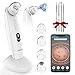 Limpiador de Poros con Camara VITCOCO Succionador de Puntos Negros Limpiador Facial Extractor Puntos Negros Recargable USB con Pantalla LED y 4 Cabezales
