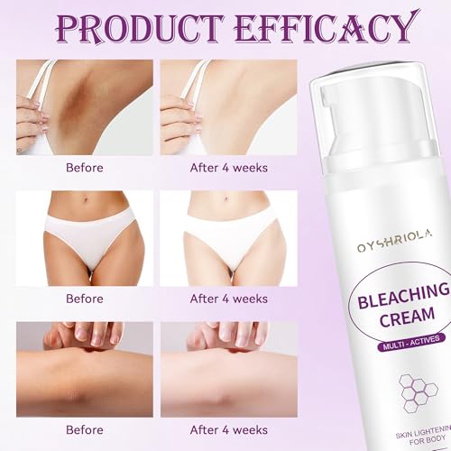 Skin Bleaching Cream, Dark Spot Remover for Body, Elbows, Knees & Intimate Areas, Moisturizing Formula, Lightweight & Fast Absorbing, 3.53 OZ