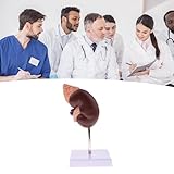 Zoom IMG-1 modello di rene a grandezza Zoom IMG-1 modello di rene a grandezza