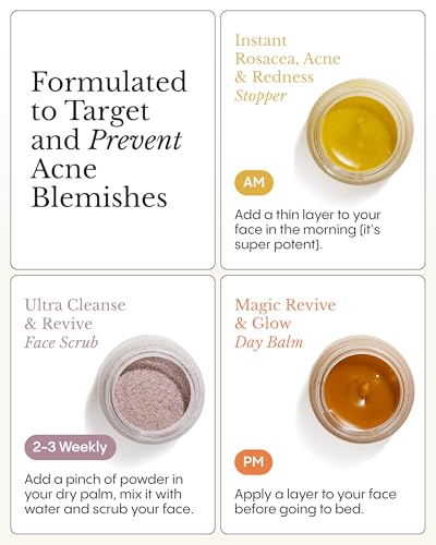 Frøya Organics The Complete Blemish System for Women | Includes Magic Revive & Glow Day Balm, Ultra Cleanse & Revive Face Scrub, Instant Rosacea, Acne & Redness Stopper | 60-Day Supply