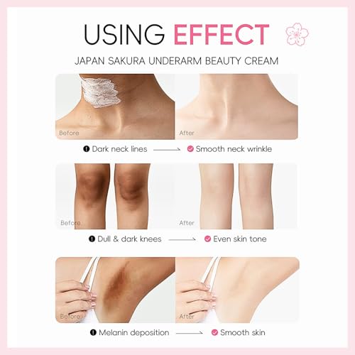 Underarm Brightening Cream, Skin Bleaching Creams, Skin Brightening Cream for Armpits/Knees/Inner Thighs/Intimate Areas, Vitamin C+Alpha-Arbutin+Niacinamide Body Lotion, 2PCS - Image 6