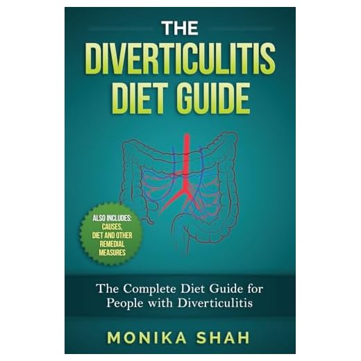 The Diverticulitis Diet Guide: A Complete Diet Guide for People with Diverticulitis (Causes, Diet and Other Remedial Measures)