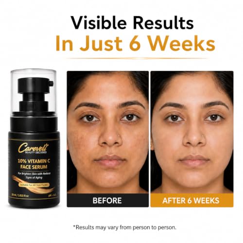 Image of 10% Vitamin C Face Serum with 5% Niacinamide, 1% Hyaluronic Acid, 0.5% Ferulic Acid & 0.1% Vitamin E | Face Serum for Glowing Skin, Dark Spots Appearance, Uneven Skin Tone & Hydration | Lightweight & Non-Sticky (30 ml)