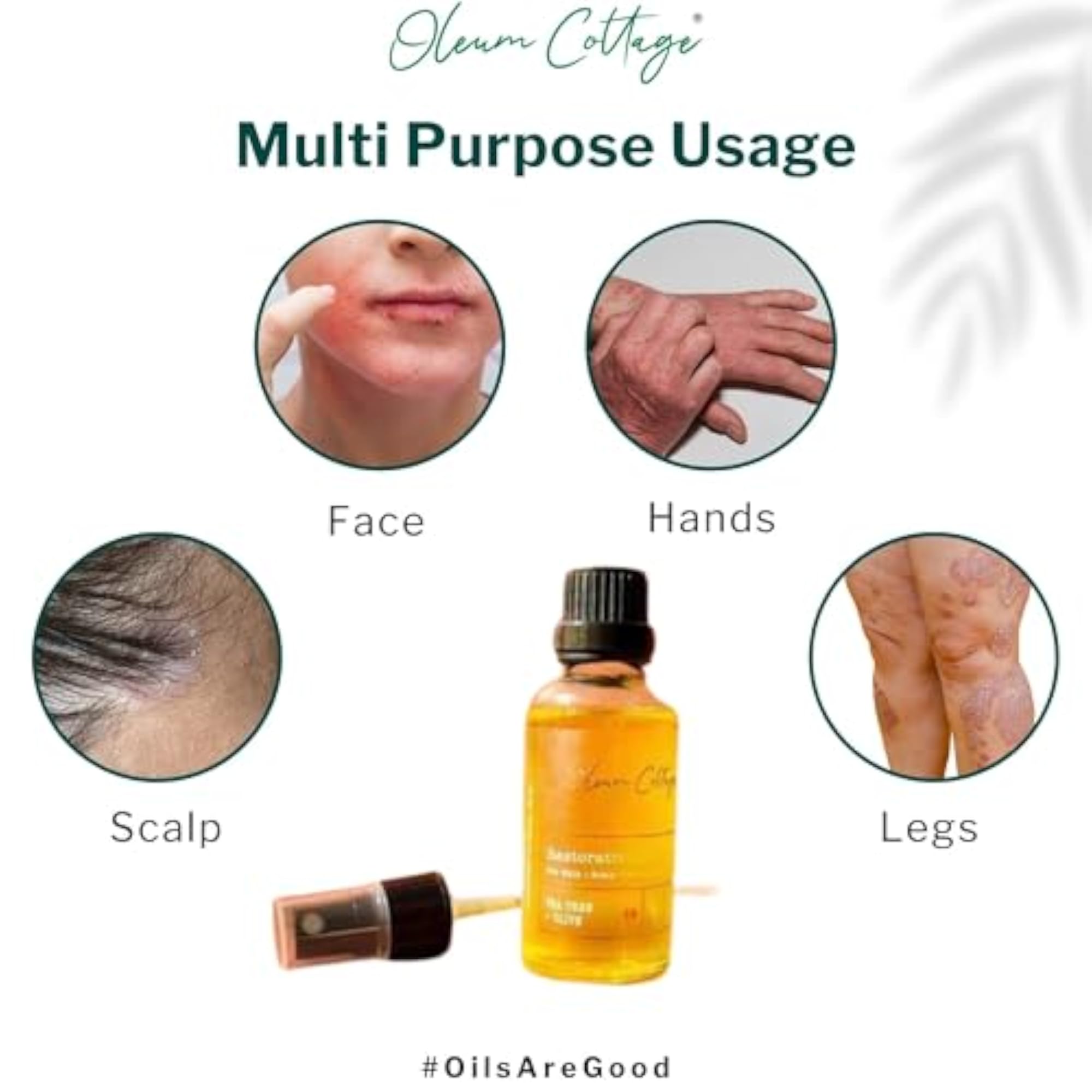 Restorative Oil for Skin Scalp Psoriasis and Eczema (50ml)