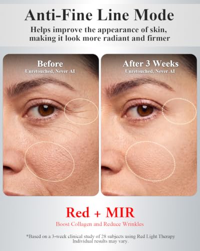 Image of Red Light Therapy for Face, Clinically Tested&FDA-Cleared, All-New2026Model