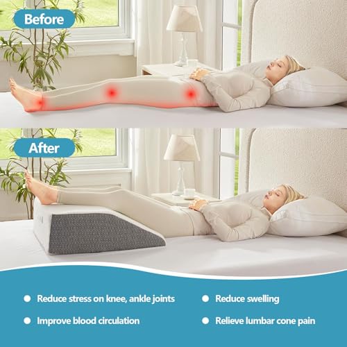 Nordjager Leg Pillow for Elevation & Support, 24"x22"x6" Memory Foam Cushion with Grey White Patterned Polyester Cover, Ideal for Improving Circulation & Relaxing Leg
