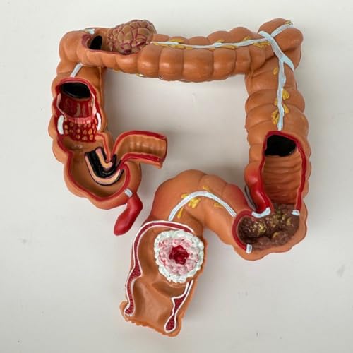 Modèle du système digestif pour illustrer vos consultations médicales - 3