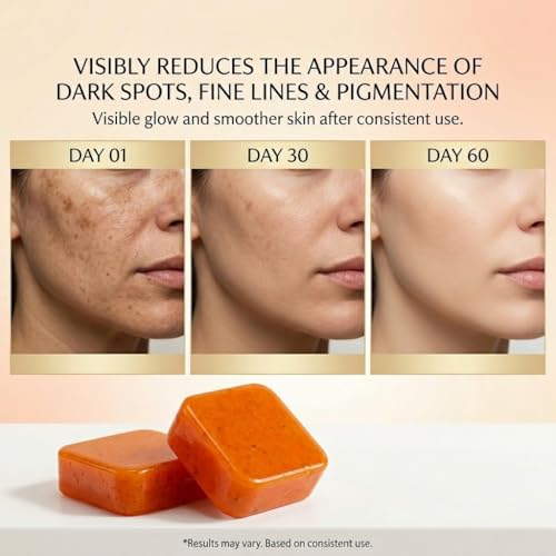 Image of Kojic Acid & Niacinamide Soap Bar for Tan Removal, Skin Brightening & Deep Cleansing | Enriched with Coconut Oil & Saffron | Helps Reduce Dark Spots, Pigmentation & Uneven Skin Tone | For Men & Women | 300 g