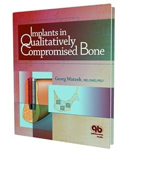 Implants In Qualitatively Compromised Bone (Hb 2004)