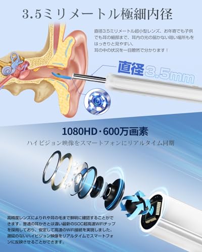 Flynet 耳かき カメラ ワイヤレス イヤースコープ 600万高画素 3.5mm 極細レンズ の商品画像 3