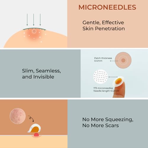 Image of bbold Microneedle Pimple Patches for face salicylic acid | Pimple Remover Acne Patch with Hyaluronic Acid Fights Acne from the Root & Reduces Acne Scarring - 45 Patches (Pack of 5)