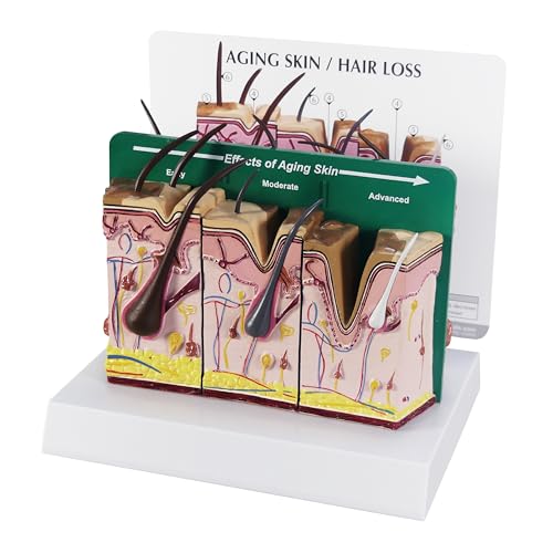 GPI Anatomicals - Aging Skin and Hair Loss Model, Replica Showing Aging and Normal Skin for Human Anatomy and Physiology Education, Anatomy Model for Doctor's Offices, Medical Learning Resources