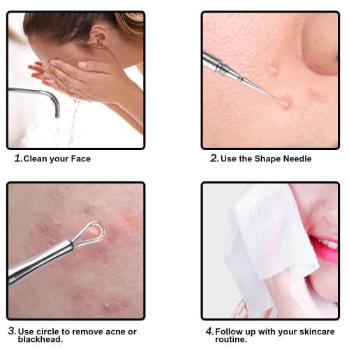 Professional Facial Milia Removal And Whitehead Extractor & Lancet - Double Ended Circle Loop & Sharp Needle Pimple Tool - 2-In-1 Blackhead & Blemish Remover - Zit And Pimple Acne (4.6In-Sliver) #TOP5