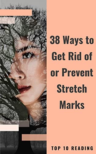 38 Ways to Get Rid of or Prevent Stretch Marks: Learn Essential Tips to Get Rid of or Prevent Stretch Marks