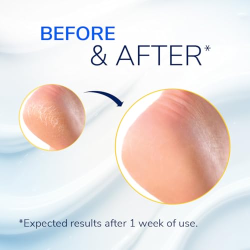 Scholl Severe Cracked Heel Repair Restoring Balm, to repair Very Dry and Cracked Heels, Intensely Moisturising for Healthy Feet with 25% Urea, Epsom Salts and Essential Oils - Image 2