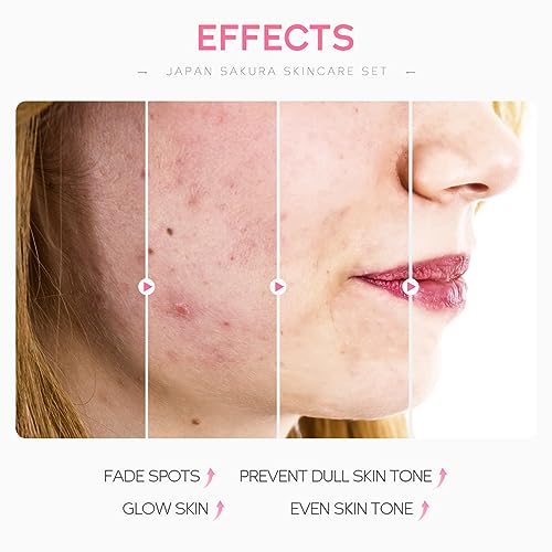 INBOLM Skincare Set Skin Care for Teenage Girls,4 PCS Skin Care Sets & Kits,Glowing Beauty Skincare Kit - Image 4