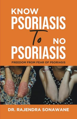 Know Psoriasis To No Psoriasis: Freedom from Fear of Psoriasis