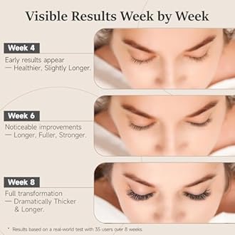 Nourishing Lash & Brow Serum – Enhances the Look of Fuller, Longer Eyelashes and Eyebrows – Gentle Formula for Sensitive Eyes – Vegan & Cruelty-Free – 0.17 fl oz (Pack of 2)