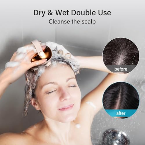 Image of Electric Scalp Massager for Hair Growth - Portable Rechargeable Head Massager, Waterproof Handheld Hair Scratcher With 8 Removable Massage Claws, Stress Relief, Gold