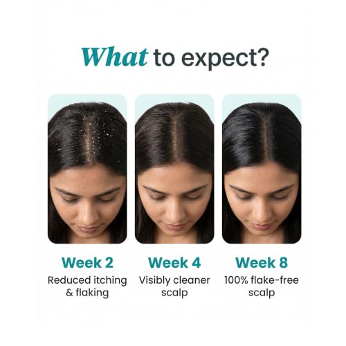 Image of Ravel PRO Anti-Dandruff Lotion+Anti-Dandruff Shampoo (Combo Pack) | Zero Flake Technology | 100% Overnight Flake Elimination - Paraben-Free, Color-Safe | For Men & Women | For All Hair Types