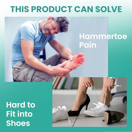 Image of Welnove Hammertoe Corrector - 6 Pack Toe Splints - Soft Gel Toe Straighteners - Realign Bent, Curled, Crooked, Claw, Hammer Toes - Toe Corrector for Men and Women, 3 Different Sizes (Blue)