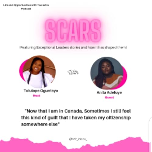 Scars Episode 2