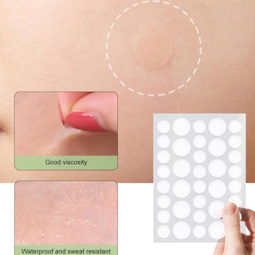 KARLOR 288 Stück Anti Pickel Patch Pimple Patches Anti Acne Spot Acnemy Unsichtbare Pflaster Makeup Gesicht Pickelpflaster Anti-Pickel 8 mm 12 mm Größen