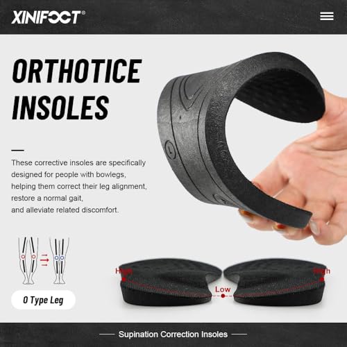 Image of XINIFOOT Supination Correction Insoles for Men & Women, Posture Correcting Orthotic Insoles for Rectify Flat Feet, O Type Legs, Bow Legs, Heel Pain (Color: Supination Insoles)