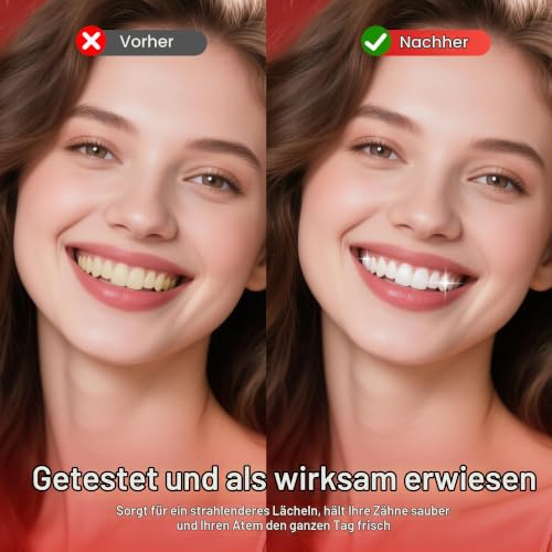 SP-6 Probiotic Whitening Zahnpasta für Zahnaufhellung und frischen Atem, 6 Probiotika-Formel für gesundes Zahnfleisch, fluoridfrei… – Ansicht 4