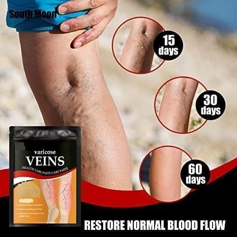 Image of Varicose Veins Relief Patches - 12 PICE | Reduces Swelling, Relieves Pain, Improves Blood Circulation & Vein Health | Herbal, Skin-Friendly & Instant Pain Relief (pack of 2)