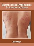 Systemic Lupus Erythematosus: An Autoimmune Disease