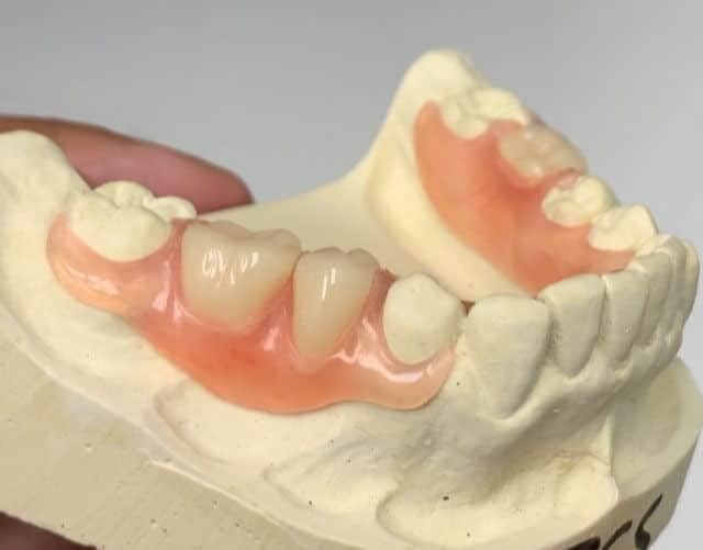 Image of Custom-Made Upper & Lower Flexible Partial Denture | Natural-Looking Teeth | Comfortable & Durable Pink Base | Dental Prosthetic for a Confident Smile