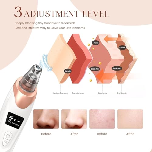 Image of 5 in 1 Multi-Function Blackhead Whitehead Remover Device, Skin Cleaner, Pimple Removal Tool, Acne Pimple Cleaner Vacuum Suction for Men and Women (5 in 1 Plus Blackhead) (white)