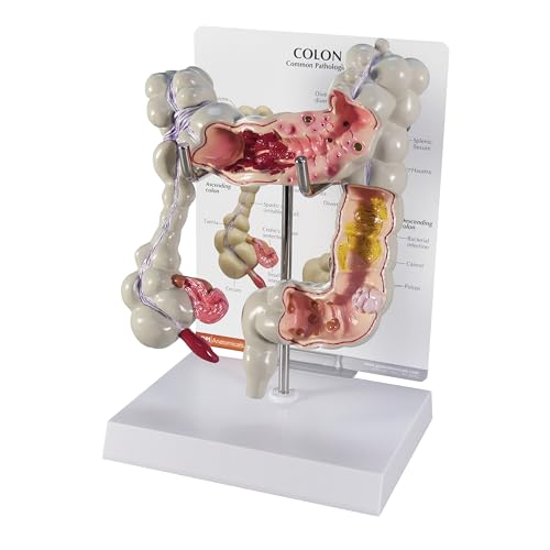 GPI Anatomicals - Colon Model, Replica for Human Anatomy and