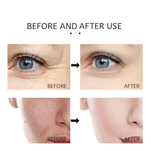 Generic Aobenz Spot Remover Serum For Face, Aobenz Remover Freckle Essence, Melasma Freckle, Sun Spot, Age Spot, Brown Spot, Spot Corrector Facial Serum For All Skin Types Spot For Men And Women thumb #5