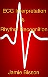 ECG Interpretation & Rhythm Recognition