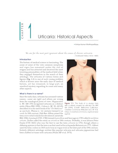 Image of URTICARIA AND ANGIOEDEMA CURRENT INSIGHTS AND UPDATES IN 2025 2ED (HB 2026)