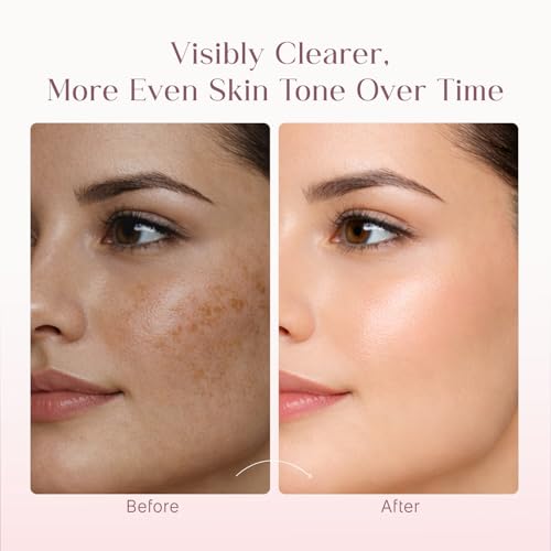 Image of Seoulskin Kojic Acid Skin Lightening Cream, Pack of 2 | With Kojic Acid, Niacinamide & Alpha Arbutin | Skin Brightening Moisturizer for Glowing Skin | Helps Reduce Dark Spots, Pigmentation & Tan | For Men & Women